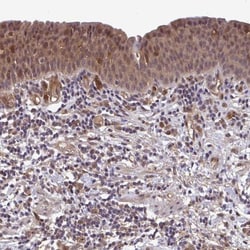 TIGAR/C12orf5 Antibody, Novus Biologicals 0.1mL; Unlabeled:Antibodies,